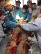 南昌针刀课几号举行