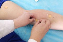 哪里有好的穴位埋线培训班？